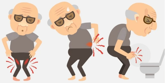 Symptomen van prostatitis