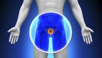 Behandeling van prostatitis met medicijnen